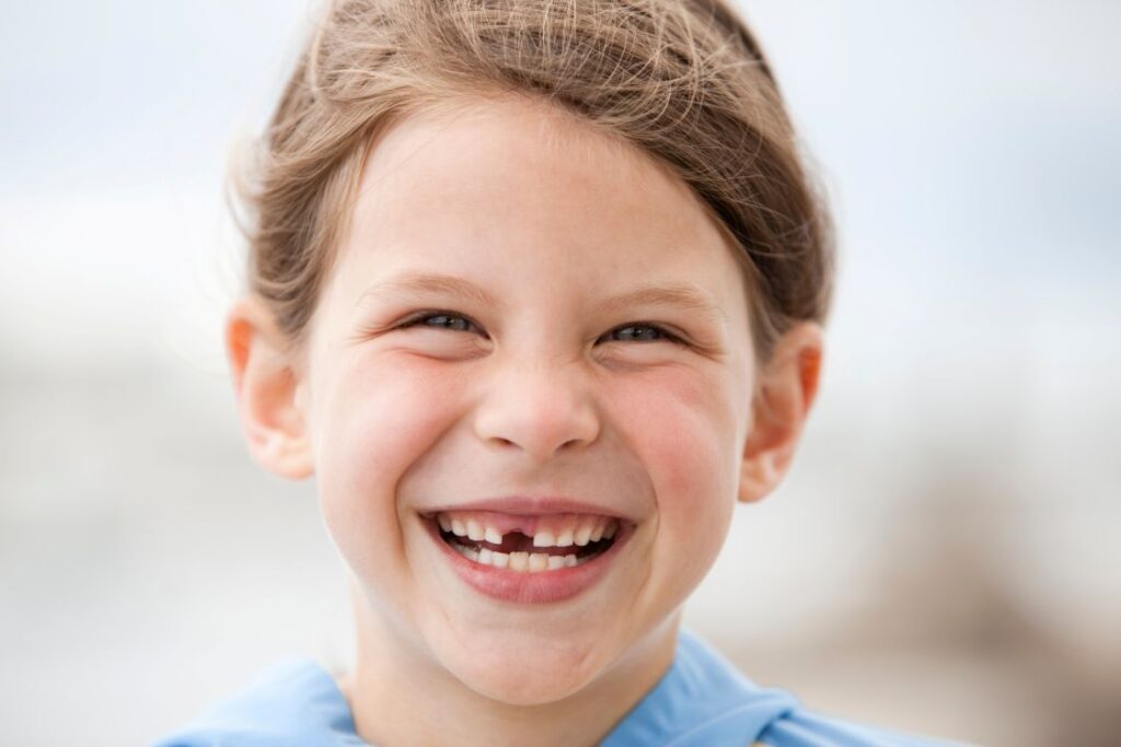 A little girl with a missing tooth.